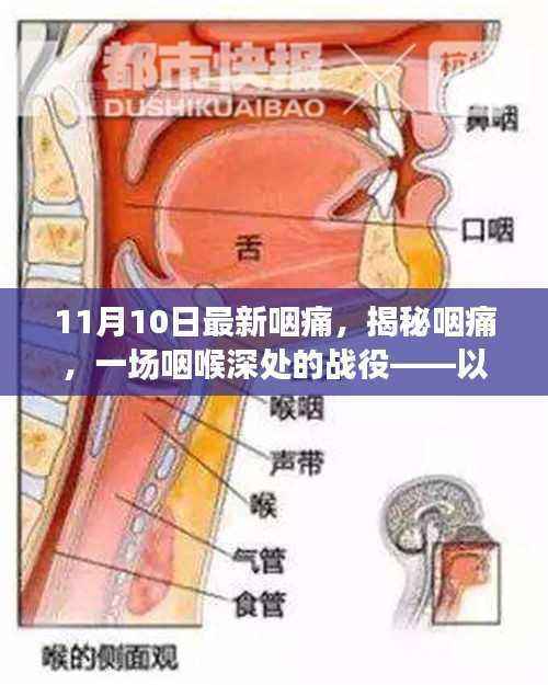 揭秘咽痛,咽喉深处的战役——最新日期下的背景、事件、影响与时代地位