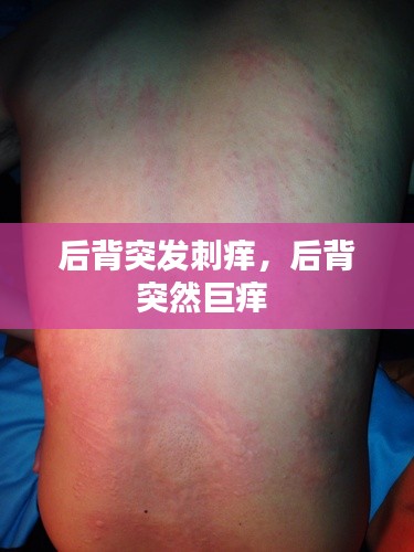后背突发刺痒,后背突然巨痒